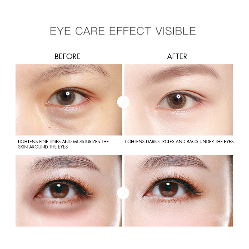 Wholesales OEM ODM Skincare Moisturizing Whitening Anti Aging Brightening Galvanic Eye Cream