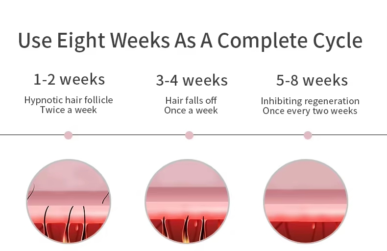 Portable Handheld IPL Epilator IPL Hair Removal Device Ice Cooling Home Use Painless Hair Remover Epilator for Whole Body