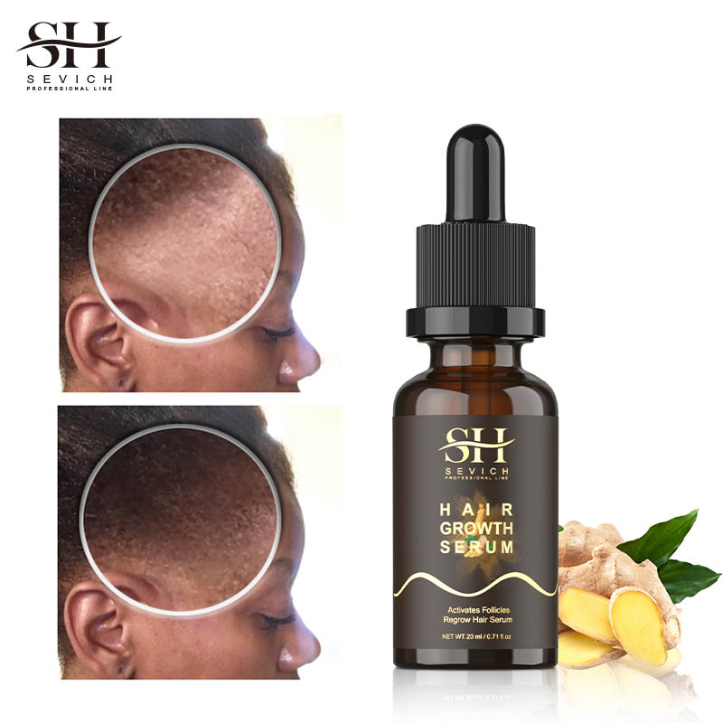 Best Hair Regrow Essential Oil for Dry Hair