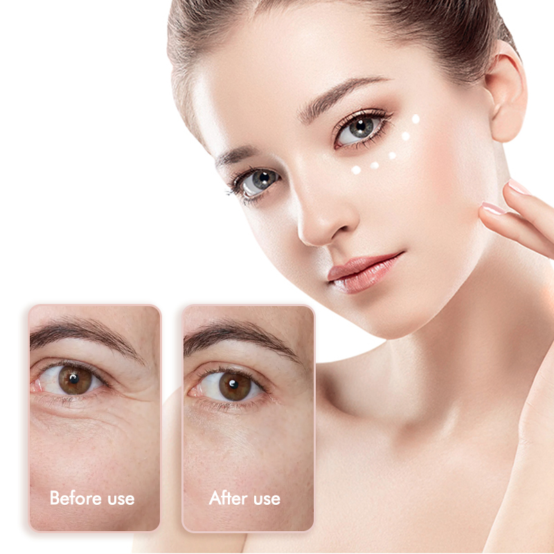 Herbal Flower Extract Anti-Aging Reduce Dark Circles Puffiness Eye Cream