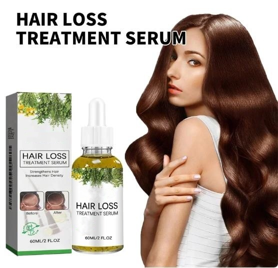 Repairing Hair Cruelty Free Anti Hair Loss Treatment Natural Rosemary Hair Growth Oil Serum