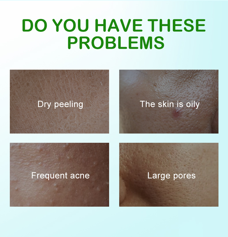 Beauty Cosmetics Skin Care Antin Aging Wrinkles Pimples Remover Tea Tree Skin Care Set