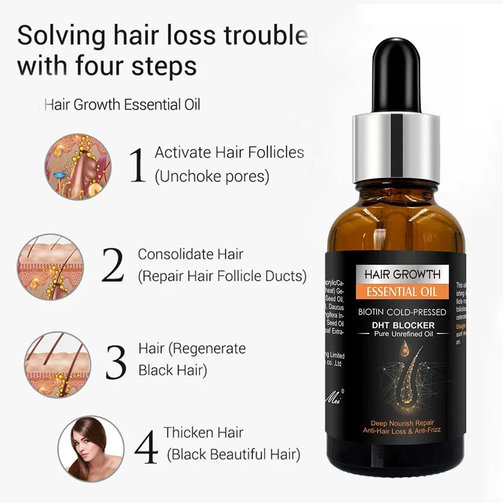 OEM/ODM Wholesale Organic Ginger Hair Essential Oil Natural Herbal Leave-in Scalp Care