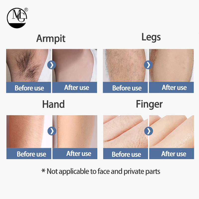 Smooth and Hair-Free Skin Women's Body Hair Removal Cream