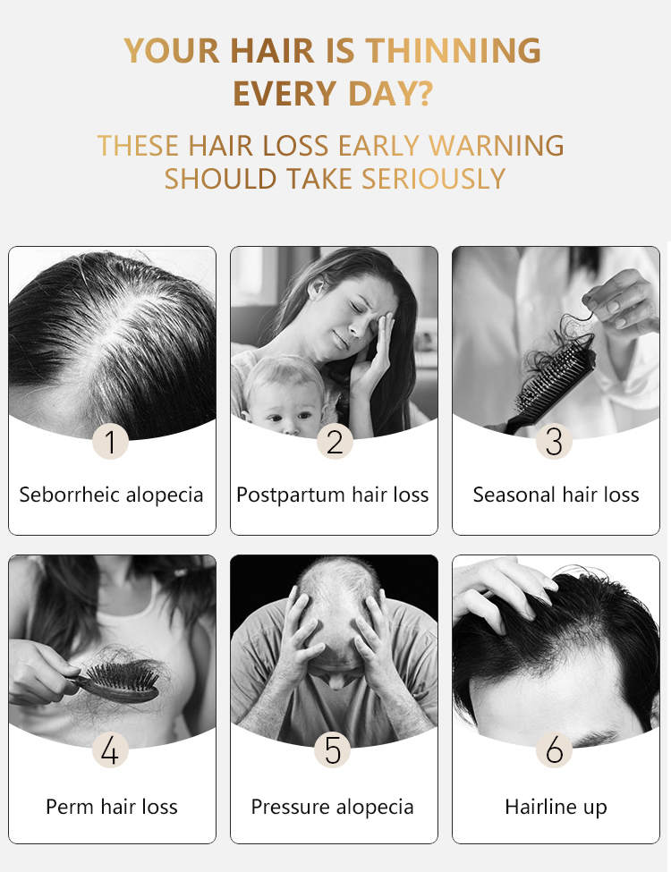 Natural Ingredients Prevents Hair Loss and Thinning Moisture The Scalp Biotin Human Hair Growth Serum