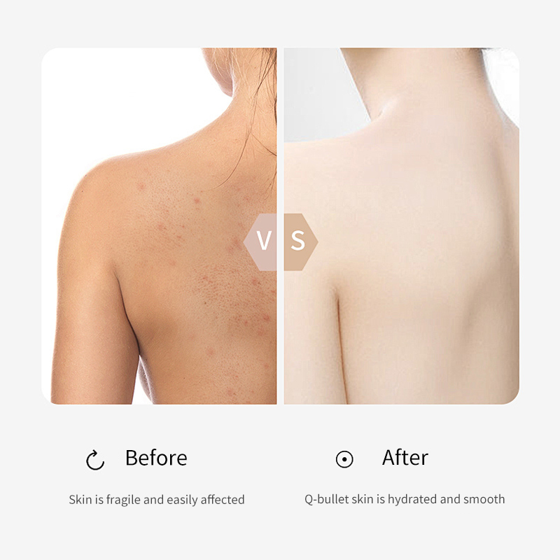 Ditong 300ml Skin Moisturizing Exfoliating Shower Gel Acne Remover Deep Cleaning Shower Gel for Brighter Softer and Smoother
