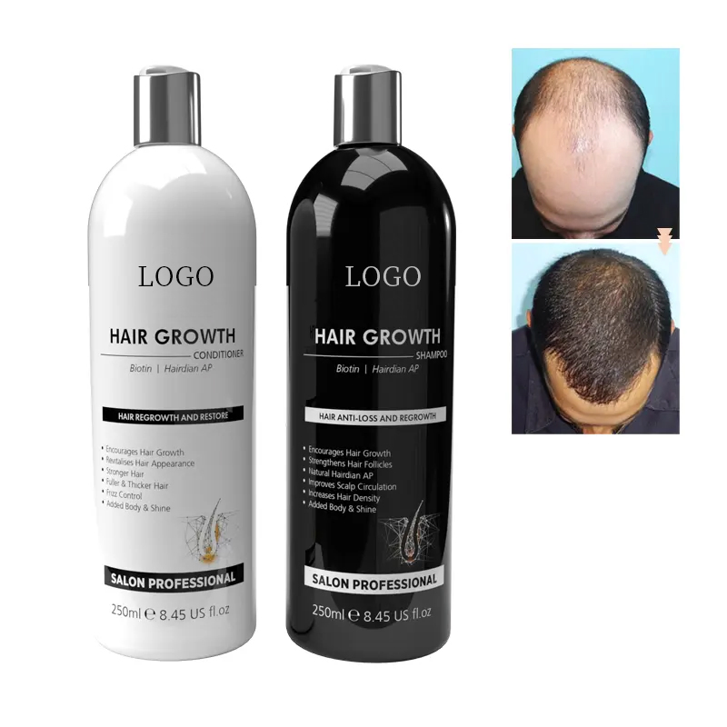 Ditong OEM/ODM Shampoo and Conditioner for Hair Loss Prevention
