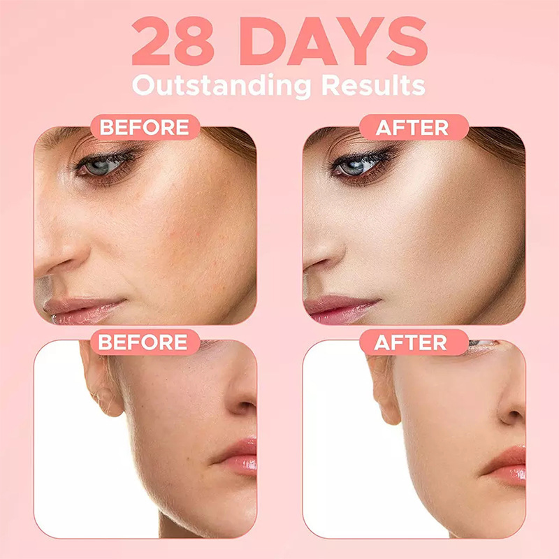 Facial Whitening Essence 4 in 1 Anti Aging Hyaluronic Acid Niacinamide Vitamin C E Repair Face Serum Skin Care