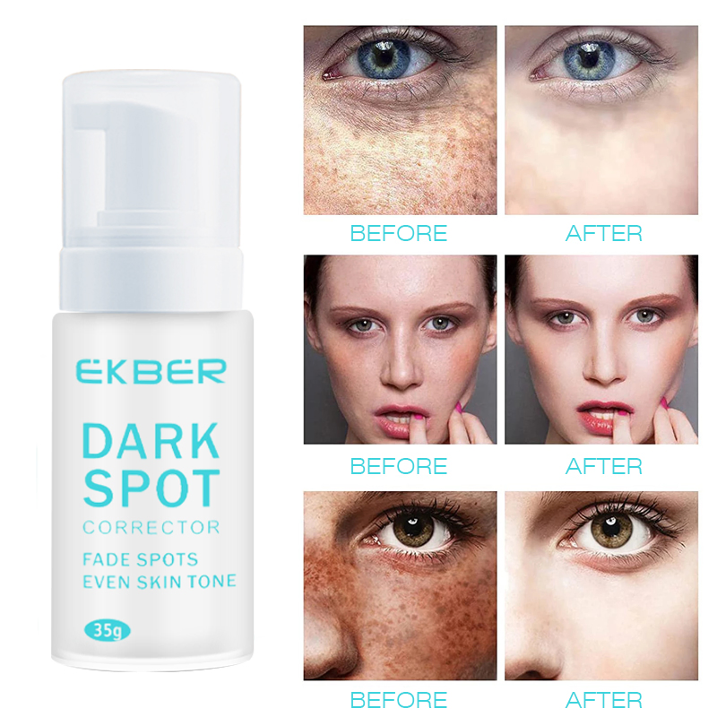 Wholesale Best Skin Care Whitening Face Care Removal Dark Spot Corrector Face Cream Treatment Cosmetic Skin Care Beauty Products Lightening Cosmetics Remove