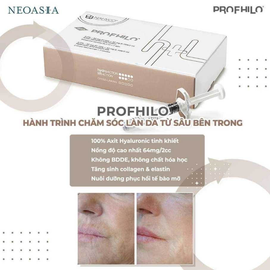 Profhilo H+L 64mg Face Lifting Nucleofill Filler Collagen Stimulating Agent