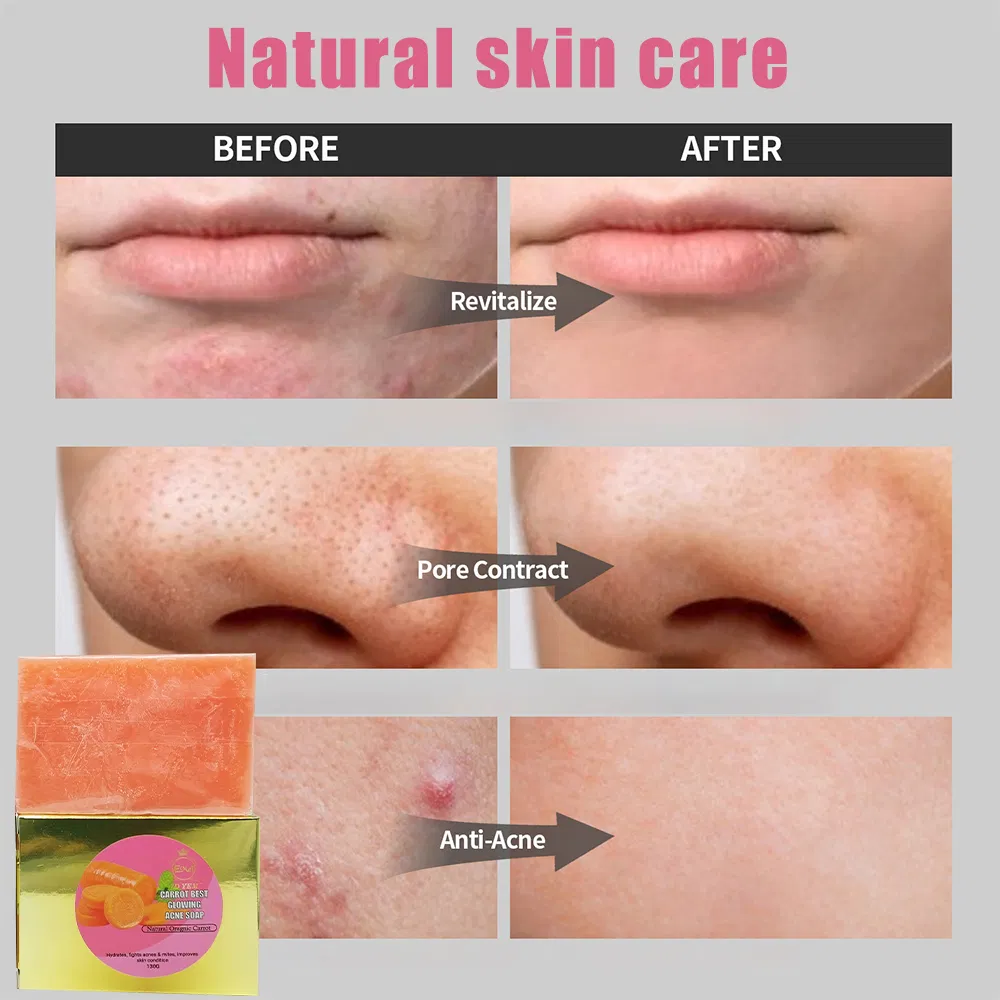 Wholesale Whitening Anti Acne Cleansing Refresh Skin Natural Ingredient Carotene Soap