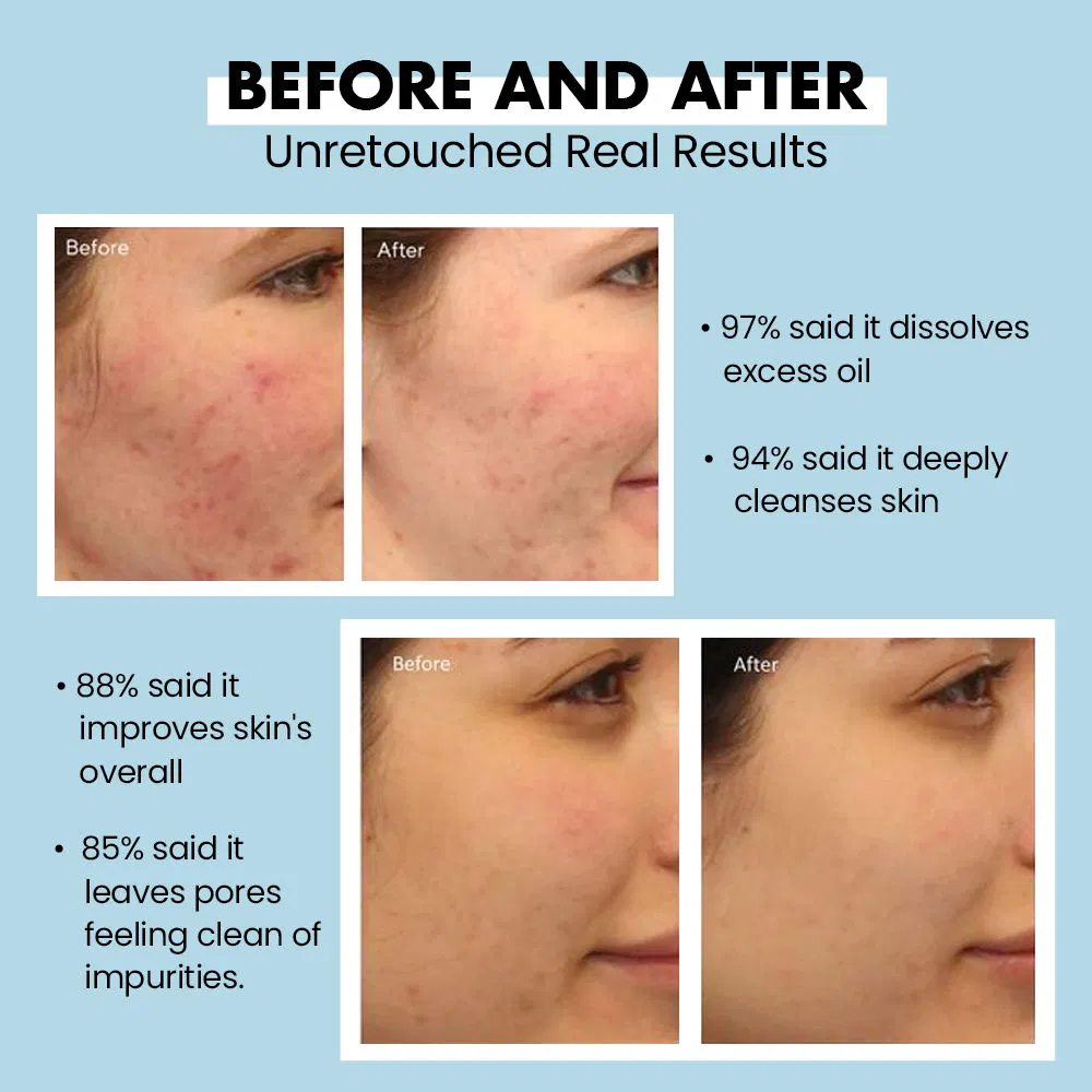 Organic Aole Vera Based Soothing Moisturizing Anti Aging Brightening Face Cleanser