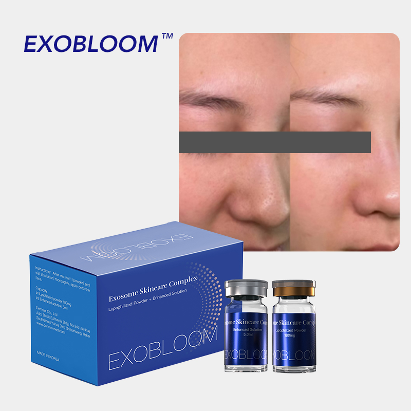 Exosomes Injections Stem Cell Exosome Essence for Skin Cell Regeneration