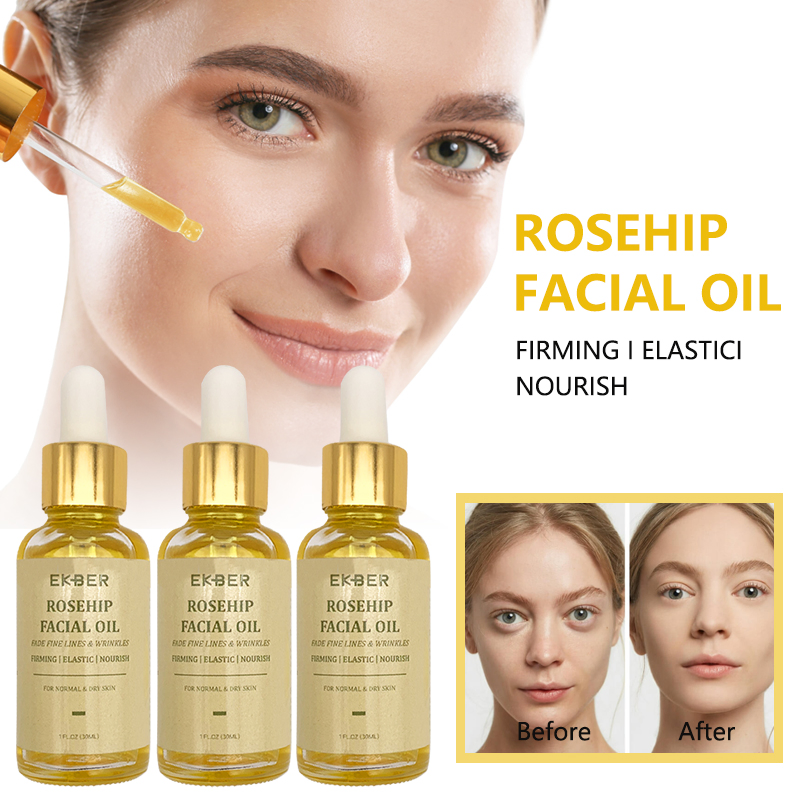Customize Logo Amazon Hot Sale Soothing Nourishing Revitalizing Pure Rosehip Seed Oil Organic Skin Care Face Rosehip Oil