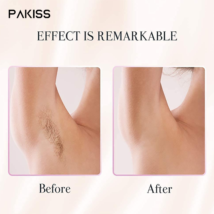 Freezing Point Hair Removal Device Portable IPL Hair Removal Machine for Home Use