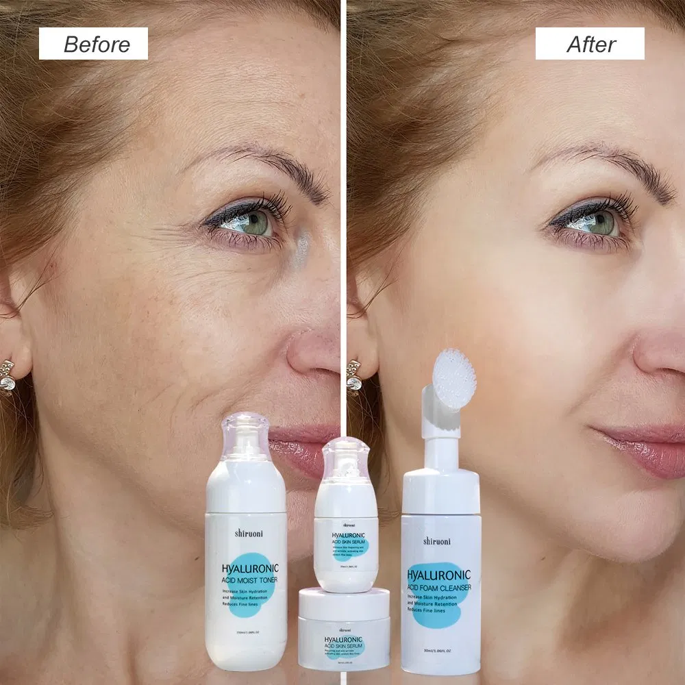 4 Pieces Hyaluronic Acid Cream/Serum/Cleanser/Toner Repairing Whitening Skin Care Set