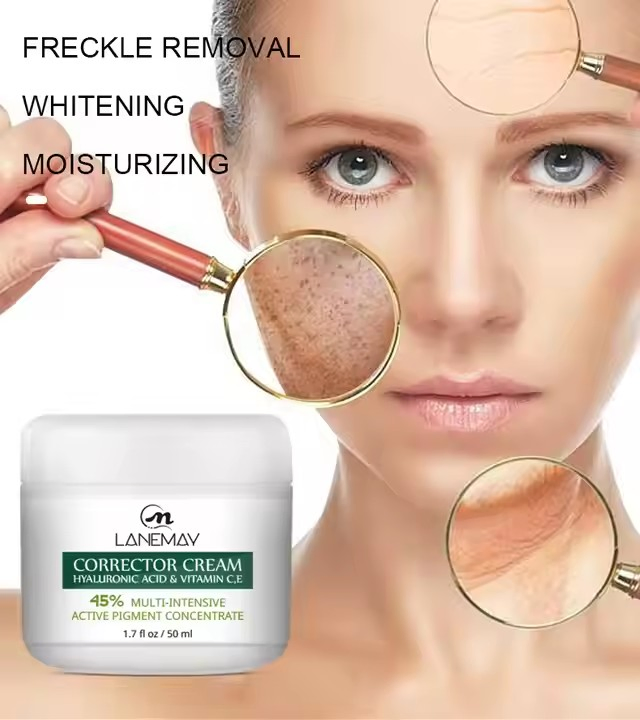 Factory Price Highly Effective OEM Natural Vegan Neck Facial Vitamin C Acne Pimples Dark Spot Strong Freckle Remover Cream