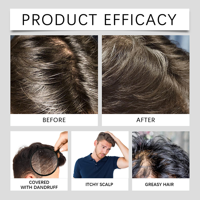 Private Label Men Shampoo Deep Conditioning Hair Care Gel Formula