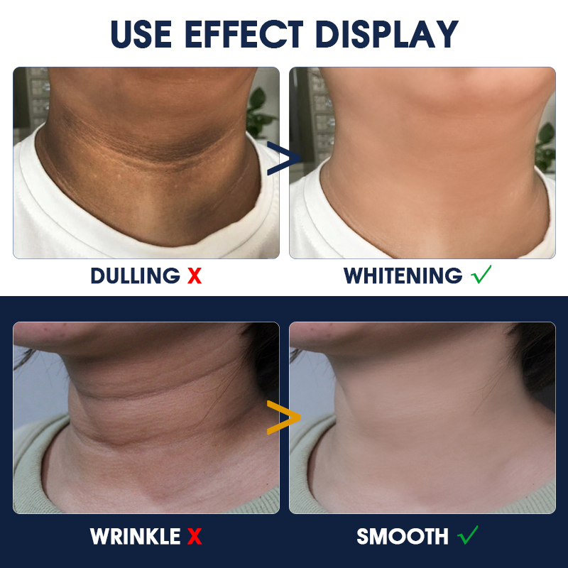 OEM Customised Neck Firming Cream Anti Wrinkle Tightener Collagen Retinol Skin Tightening