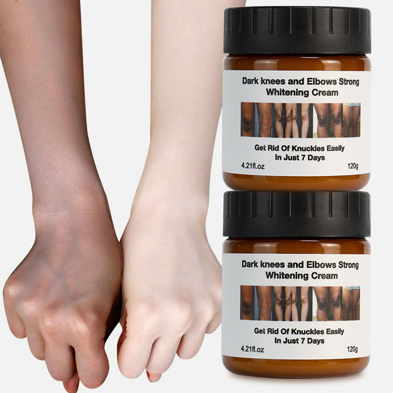 Wholesale Body Care Skin Whitening Creams Anti Dark Spot Wrinkle Knees Elbows White Lotion Moisturizer Body Whitening Cream