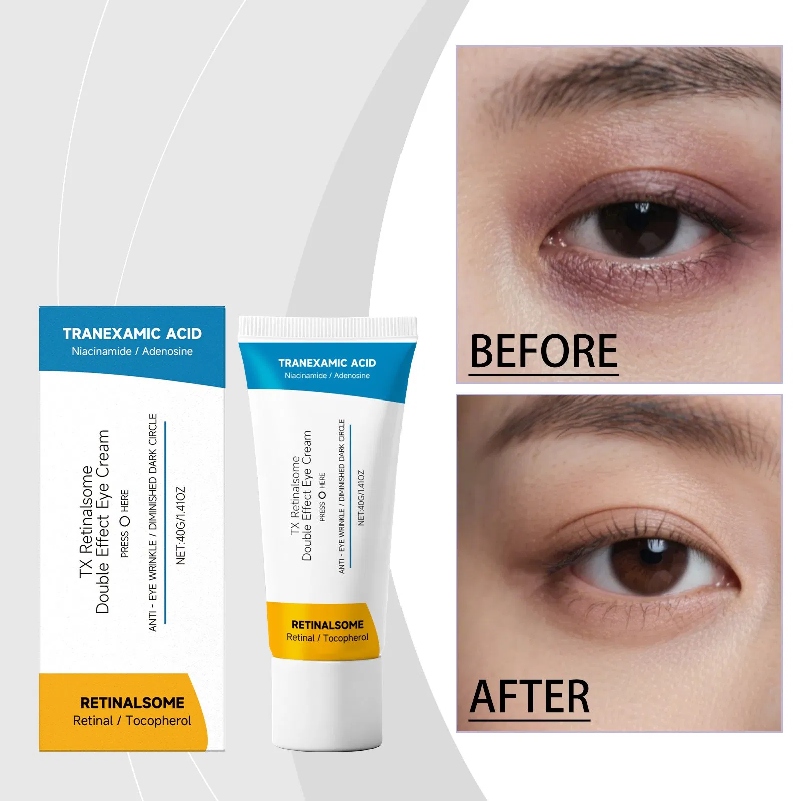 Hyaluronic Acid and Aha Infused Retinol Eye Cream Anti-Wrinkle Dark Circles Puffiness Under Eye Bags Removal Cream