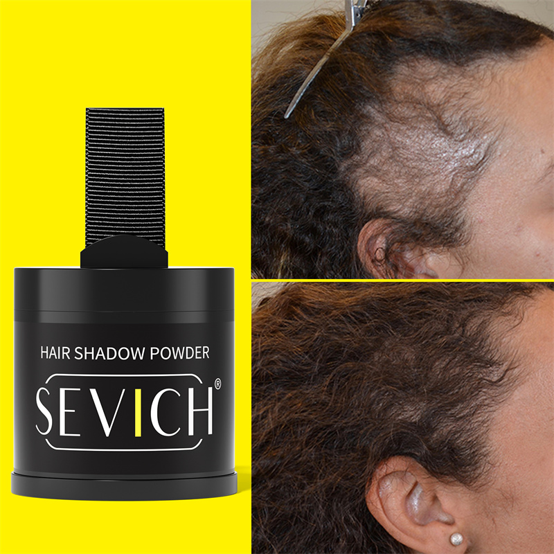 Sevich Hairline Powder Custom 10g Waterproof Long Lasting Hair Concealer Fiber Powder