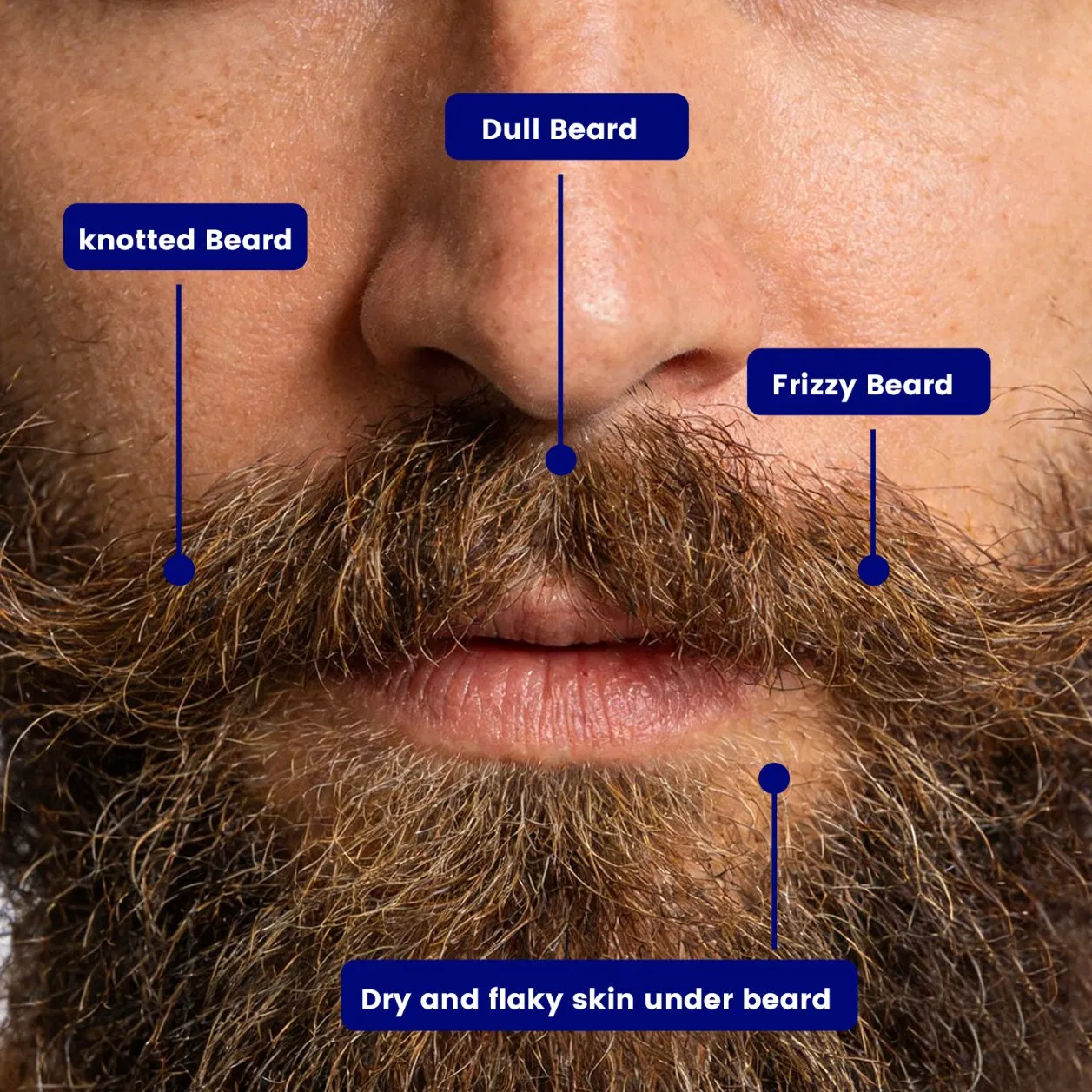 Qbeka Beard Oil for Men Natural Moisturizing Conditioner for Dry Skin, Itchy Beard, Softener and Scruff Beards Growth Treatment