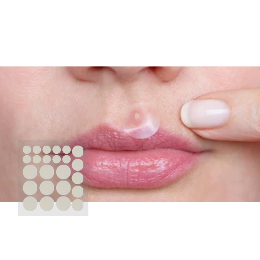 Hydrocolloid Acne Cover Patches for Fast Healing and Protection