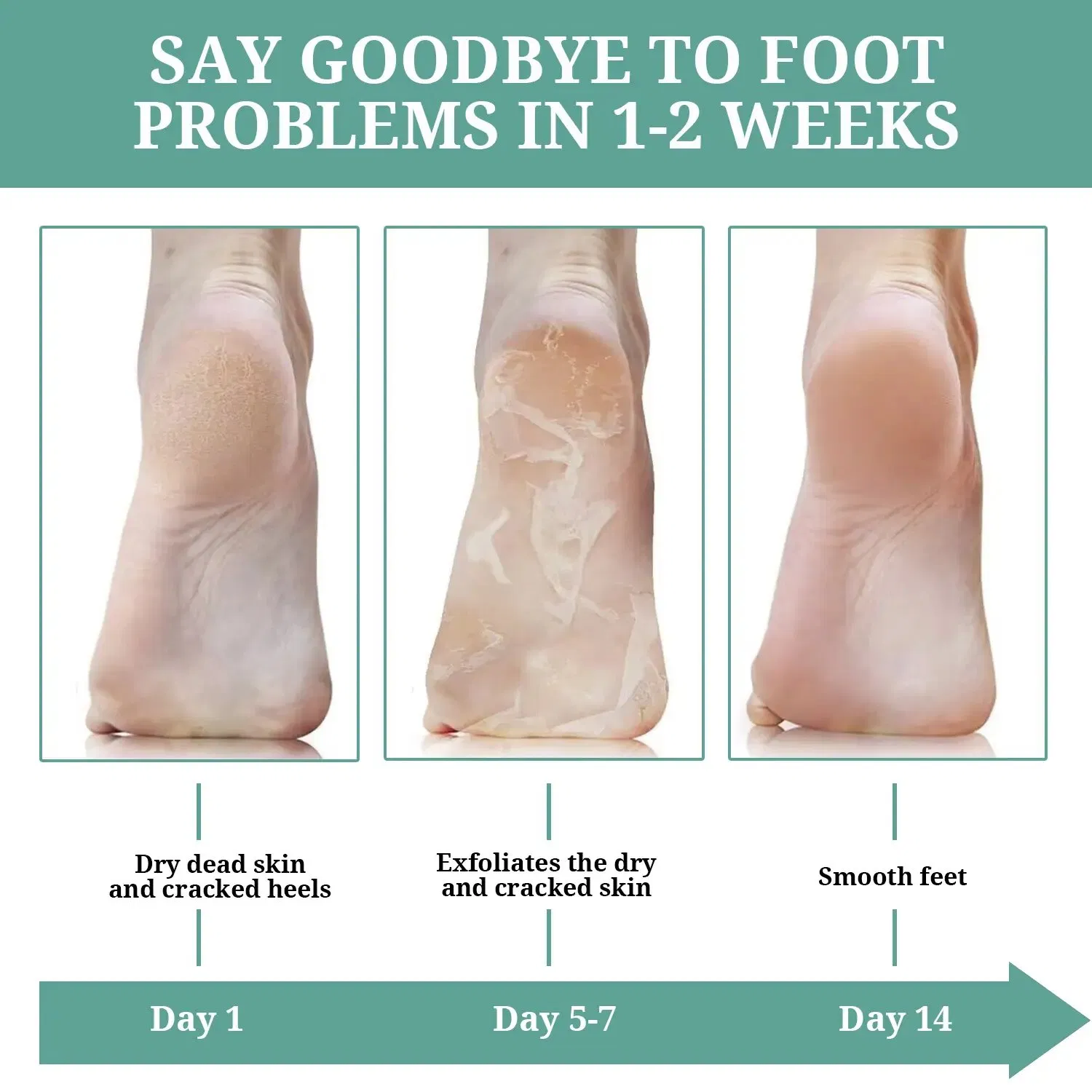 Foot Care Cow Milk Exfoliating Keep Water Foot Mask