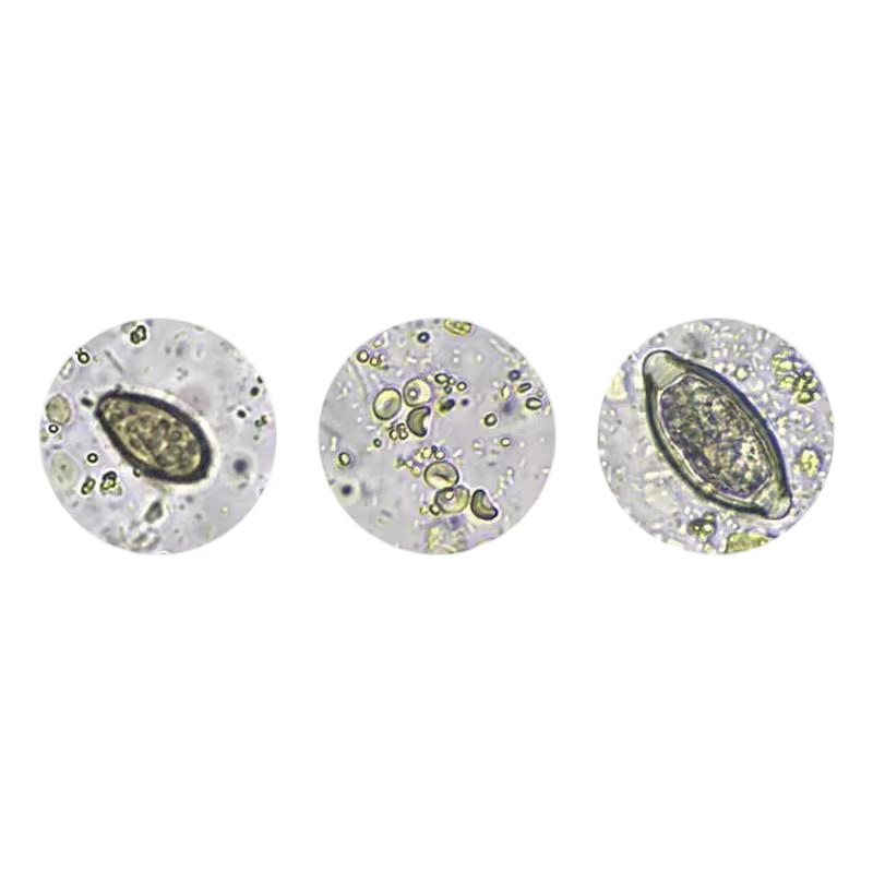 Advanced Stainer Analyzer for Enhanced Pathology Diagnostics in Hospitals