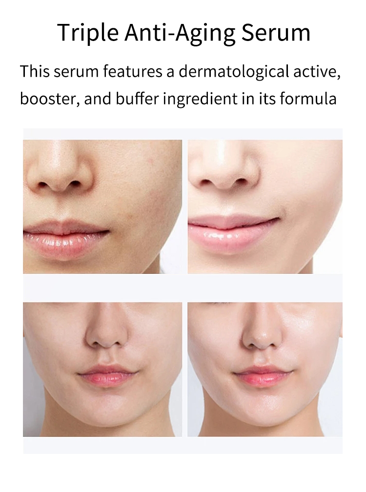 Hot Sale Cream Texture Wrinkles Cream for Daily Anti-Aging Care