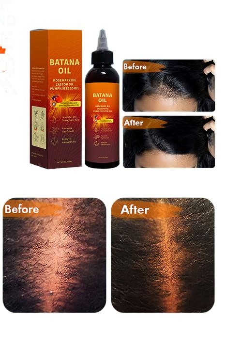 Cangty Private Label Hair Care Treatment Color Heat Protector Herbal Rosemary Hair Oil for Hair Growths