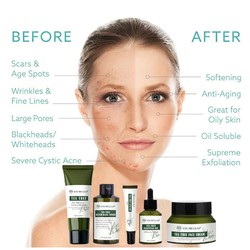 Private Label Anti Aging Hyaluronic Acid Whitening Facial Cleanser Face Wash Face Cream Tea Tree Skin Care Set
