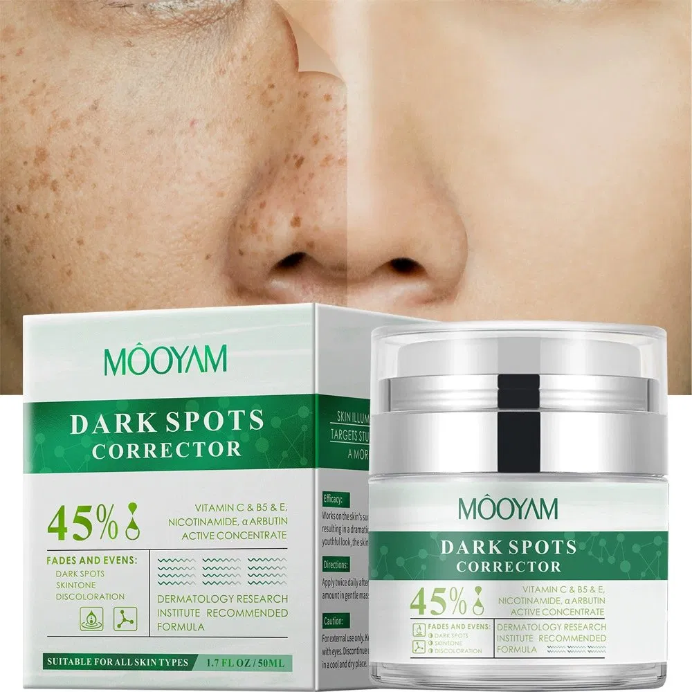 Pimples Melasma Blemish Removal Dark Spot Remover Cream Strong Bleaching Whitening Face Remove Freckles Corrector Cream