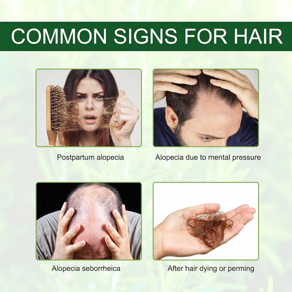 Custom Logo Hair Care Rosemary Hair Growth Oil Reduce Hair Loss Purify Scalp Essential Oil