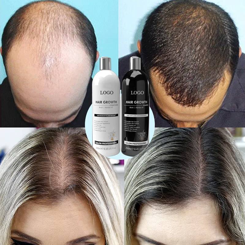 Ditong OEM/ODM Shampoo and Conditioner for Hair Loss Prevention