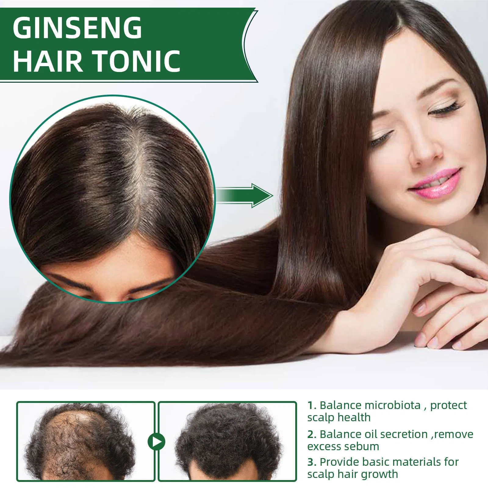 Wholesale Natural Herbals Ginseng Hair Tonic Liquid Hair Regrowth Anti Hairloss Serum Hair Growth Essential Oil Spray OEM