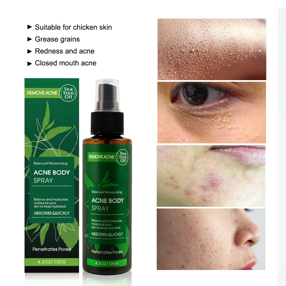 Private Label Tea Tree Oil Extract Treatment Spray Facial Mist Anti-Acne Remover Glowing Whitening Hydrating Face Body Spray