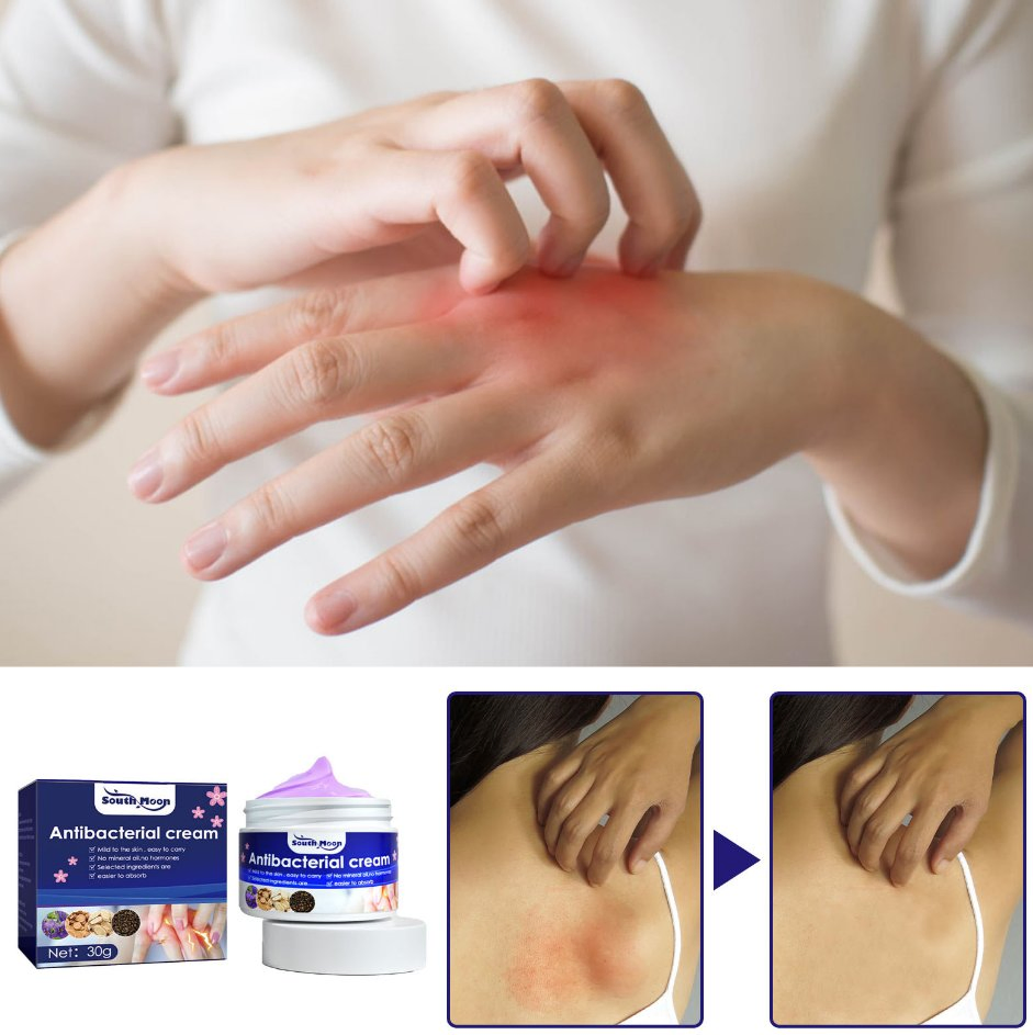 Online Wholesale in Stock Herbal Anti Bacterial Cream Mild Anti-Itch Relief From Mosquito Bites Antipruritic Herbal Cream