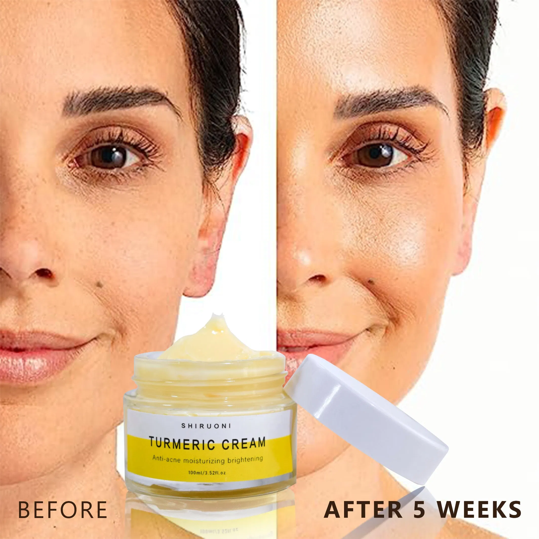 Private Label Natural Organic Turmeric Brightening Dark Spots Remove Face Toner Serum Cream Mask Cleanser Tumeric Skin Care Set