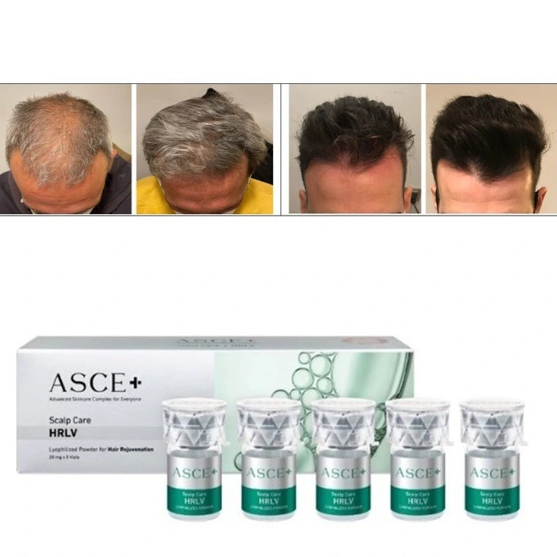 2024 Cheap Buy Exosome Asce+ Hrlv for Scalp Rejuvenation and Hair Loss Asce Scalp Hair Rejuvenation Exosome Hair Growth Hair Restoration