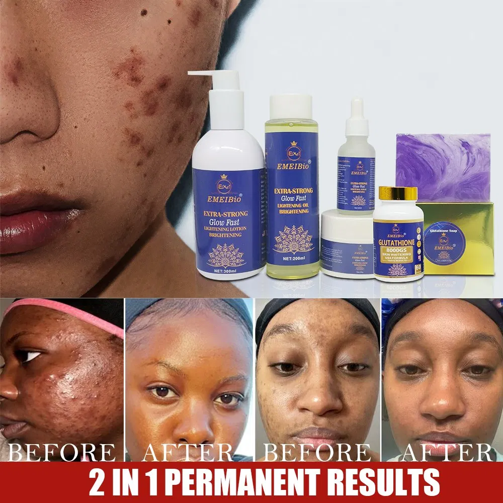 Private Brand Glutamine Whitening Set Collagen Protein Removal Moisturizing Pigment Settlement Brightening Skin Care Set