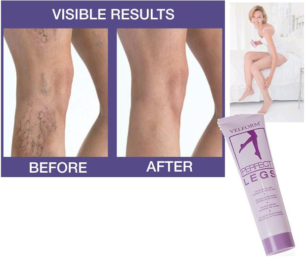 Крем для ног Velform Perfect Legs (VPL 0309)