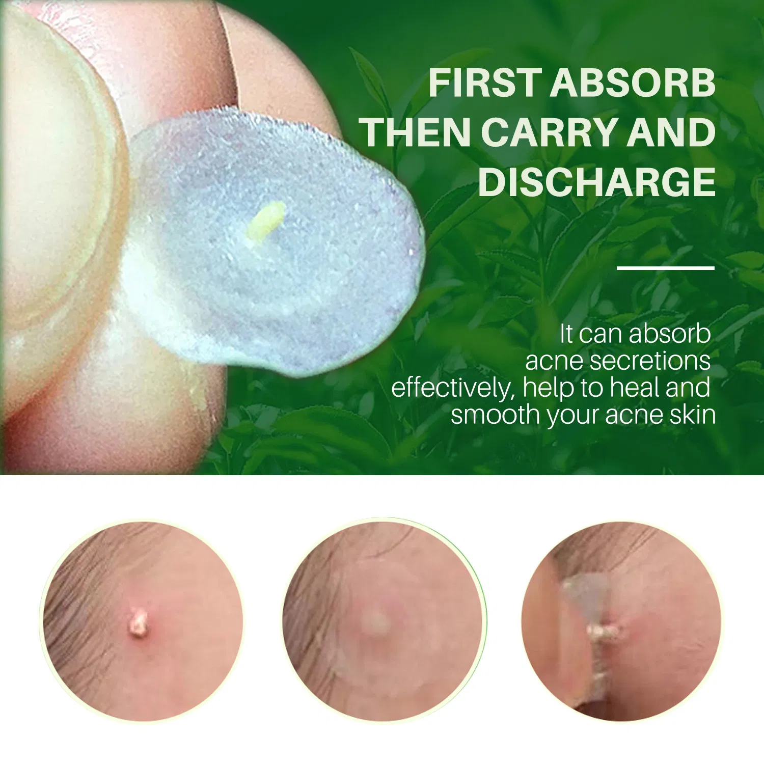 Cosmetics Facial Skin Care Acne Remover Hydrocolloid Patches Pimple Patch Acne Patch