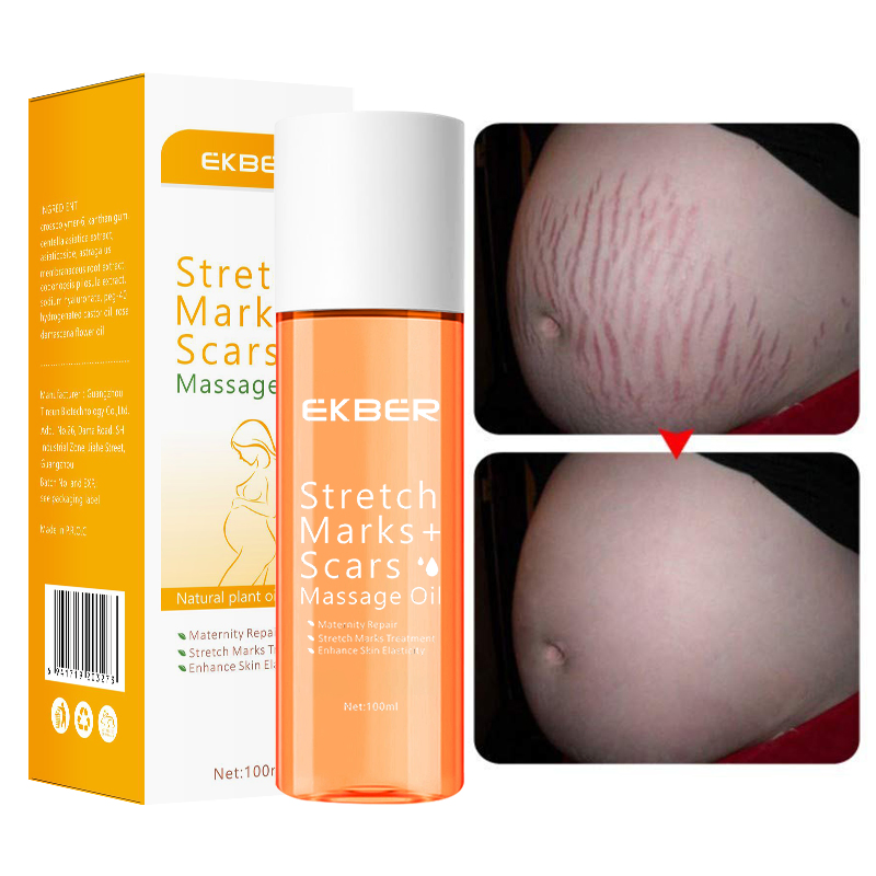 Custom Privated Label Repairing Moisturizing Stretch Mark Removal Oil Treatment Stretch Marks Anti Body Stretch Marks Oil