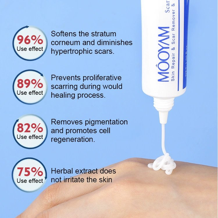Strong Effective Acne Scar Cream Pimples Stretch Marks Face Cream