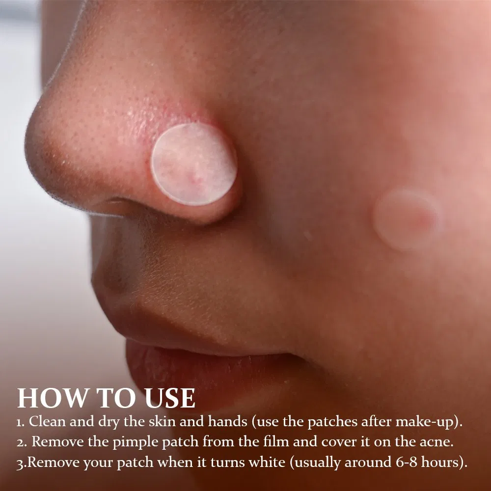 OEM Factory Price Organic Acne Treatment Pimple Patches with Tea Tree Face Care