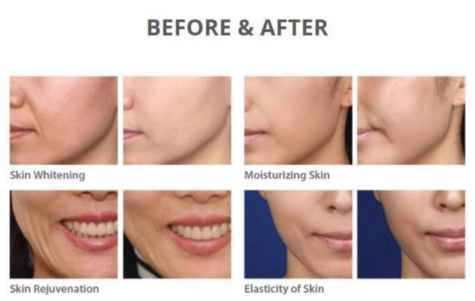 Dermeca Pdrn Baby Skinbooster Polydeoxyribonucleotide Promoting Collagen Production