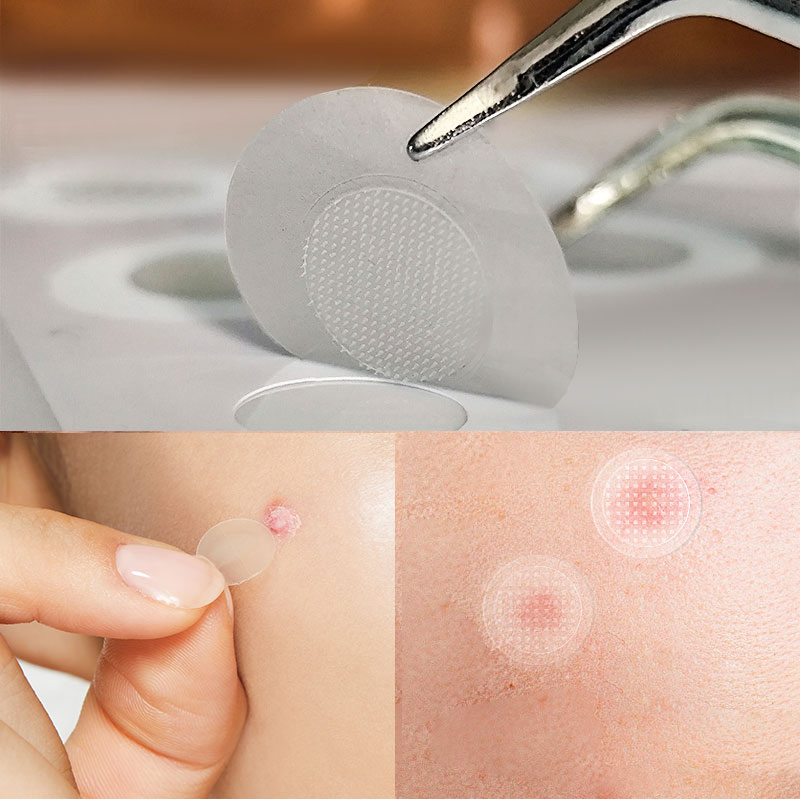 Пластыри от прыщей с микроиглами, медицинский класс