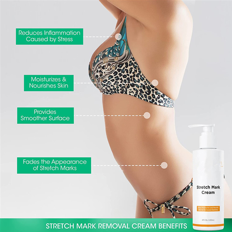 Private Label Natural Moisturizer Cream Advanced Stretch Mark Removal Cream